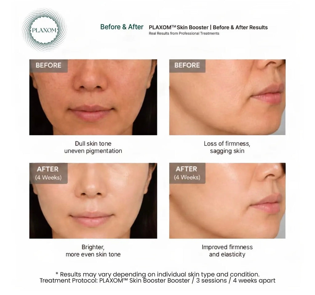 *new* Plaxom Skin Booster (exosomes, PDRN, PLLA, CaHA, GF)  (1 Vial)