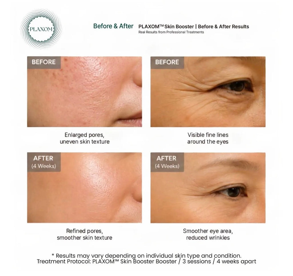 *new* Plaxom Skin Booster (exosomes, PDRN, PLLA, CaHA, GF)  (1 Vial)